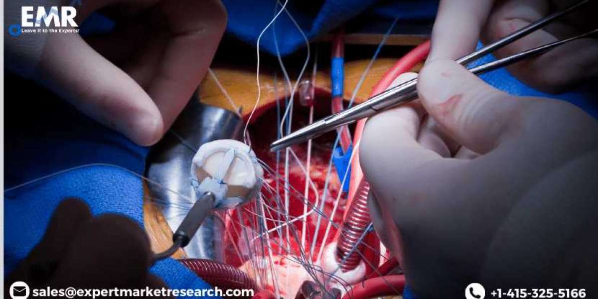 Global Aortic Valve Replacement Devices Market Size, Share, Price, Trends, Report, Forecast 2022-2027