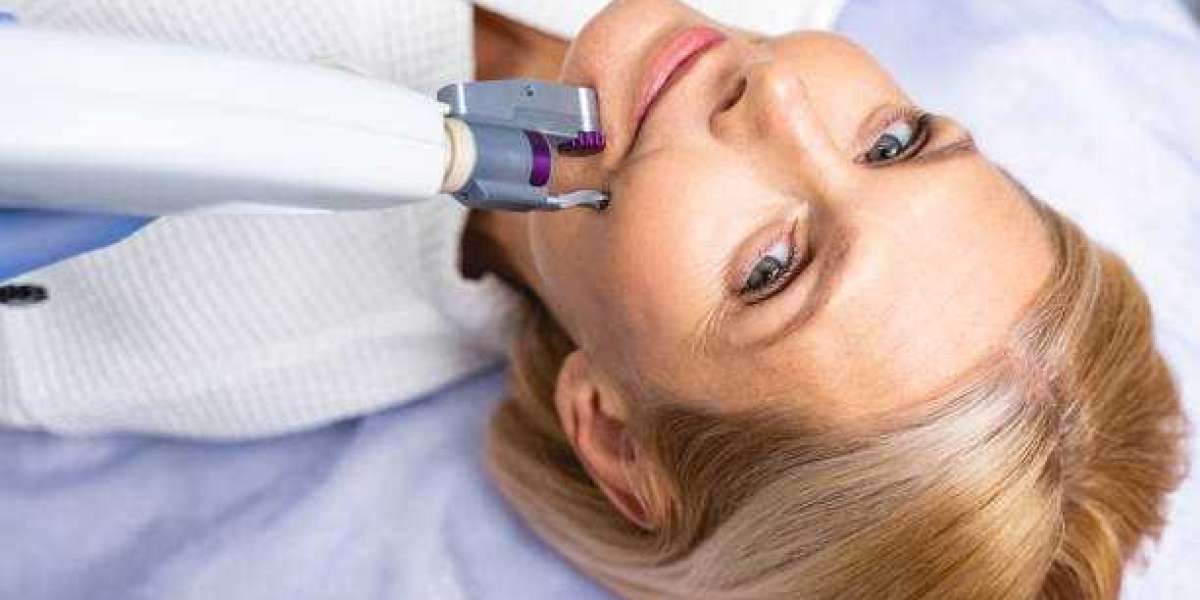 Revolutionizing Aesthetic Care: The Unveiling of Hair Reduction Laser Treatment