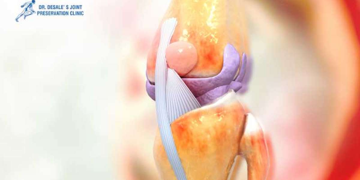 Understanding Knee Replacement: A Comprehensive Guide by Dr. Ajinkya Desale