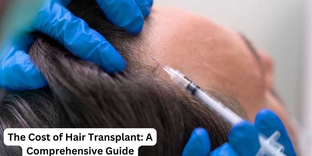 The Cost of Hair Transplant: A Comprehensive Guide