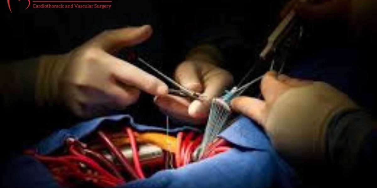 Dr. Brijmohan Singh - Best Open Heart Surgeon In Bhavnagar